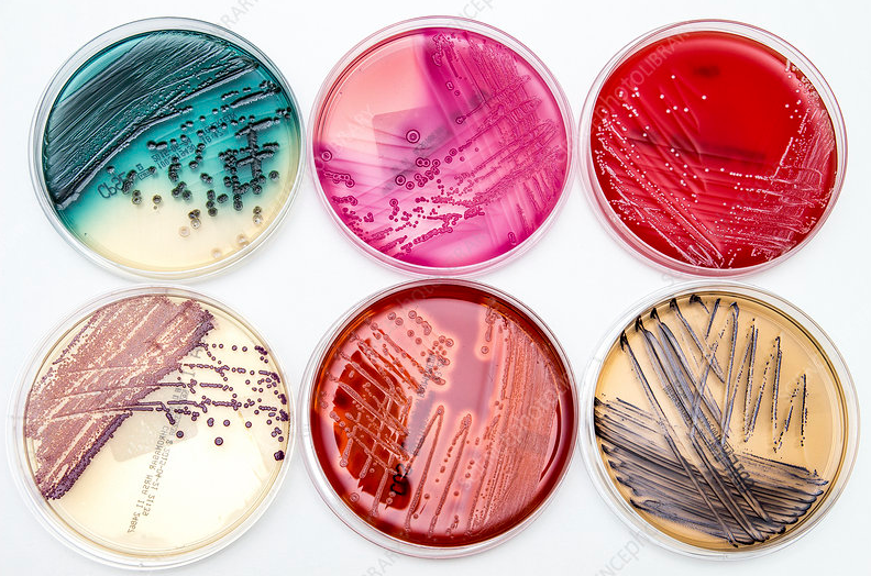 Môi trường pca là gì? tất tần tật về plate count agar (pca)
